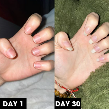 Nail Nourish™ Cuticle & Nail Oil Pen